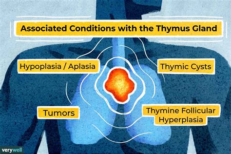Thymus Gland: What It Is and How It Works .